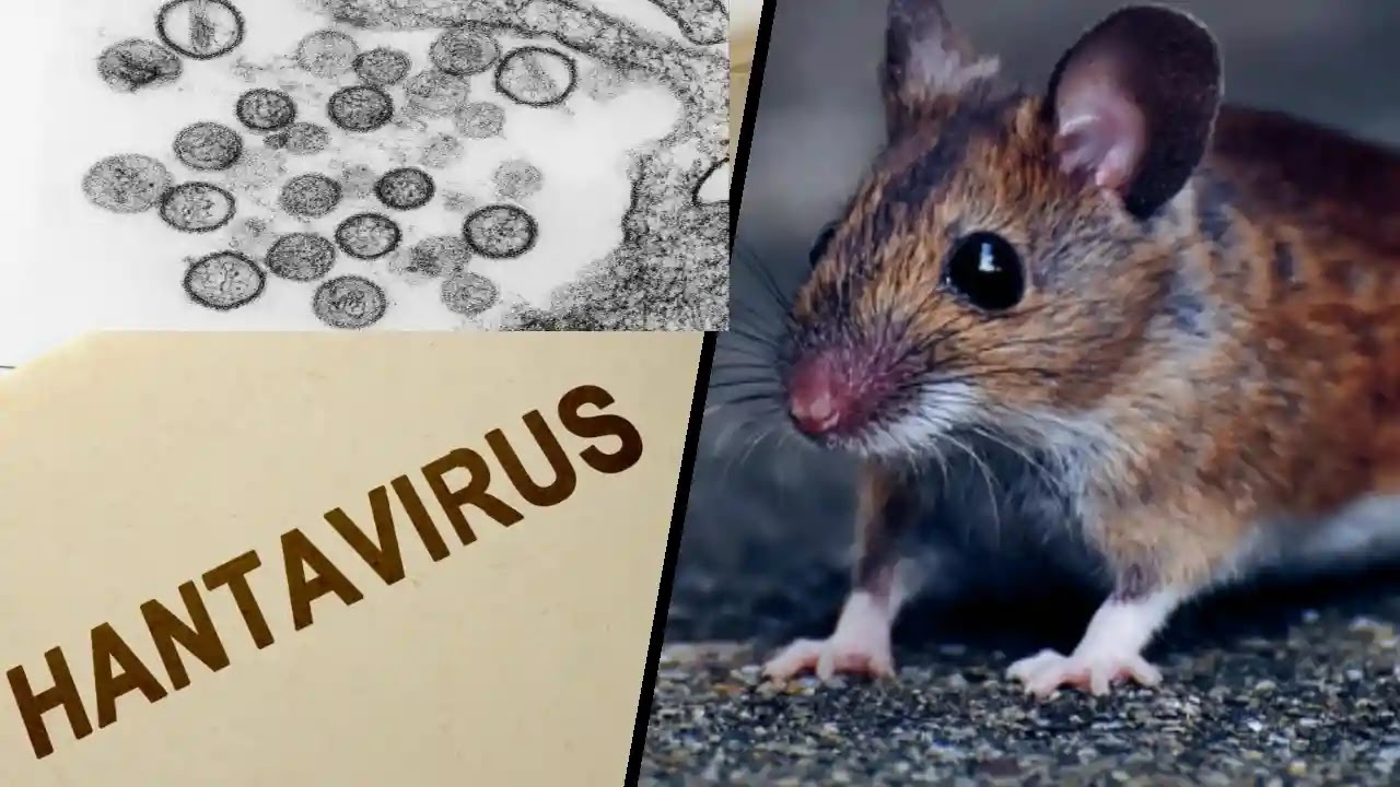 Hantavirus